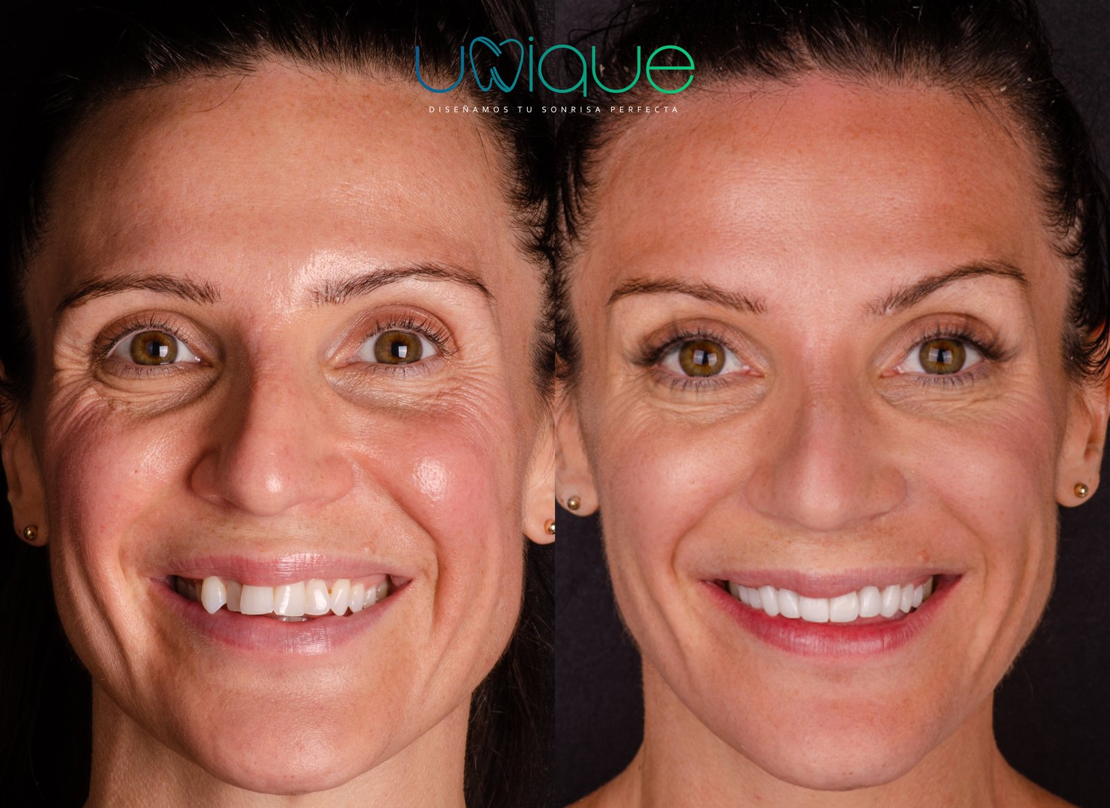 Resultado dental antes y después 4