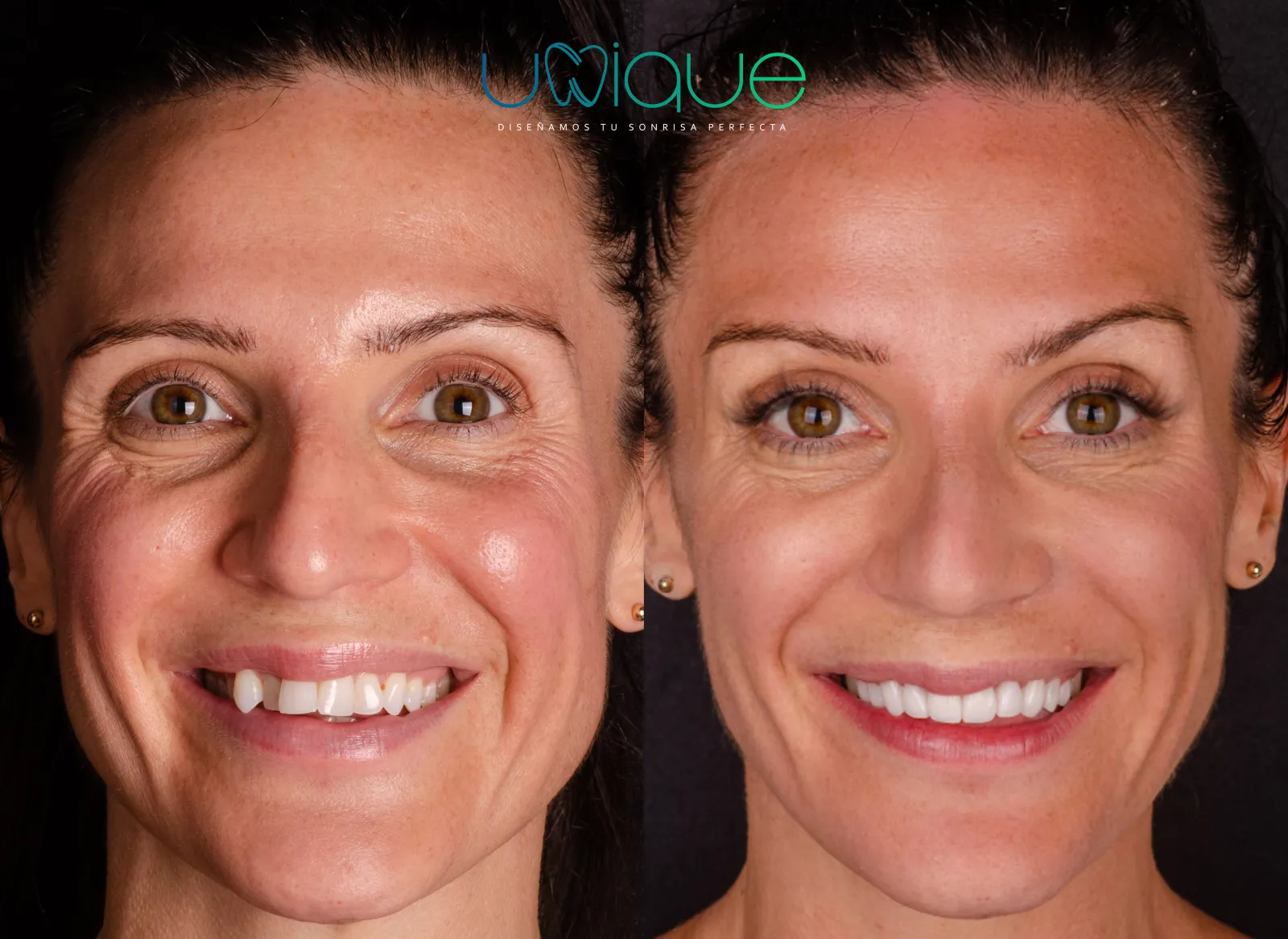 Resultado dental antes y después 4