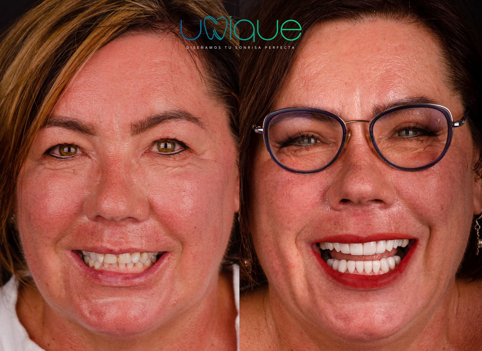 Resultado dental antes y después 5