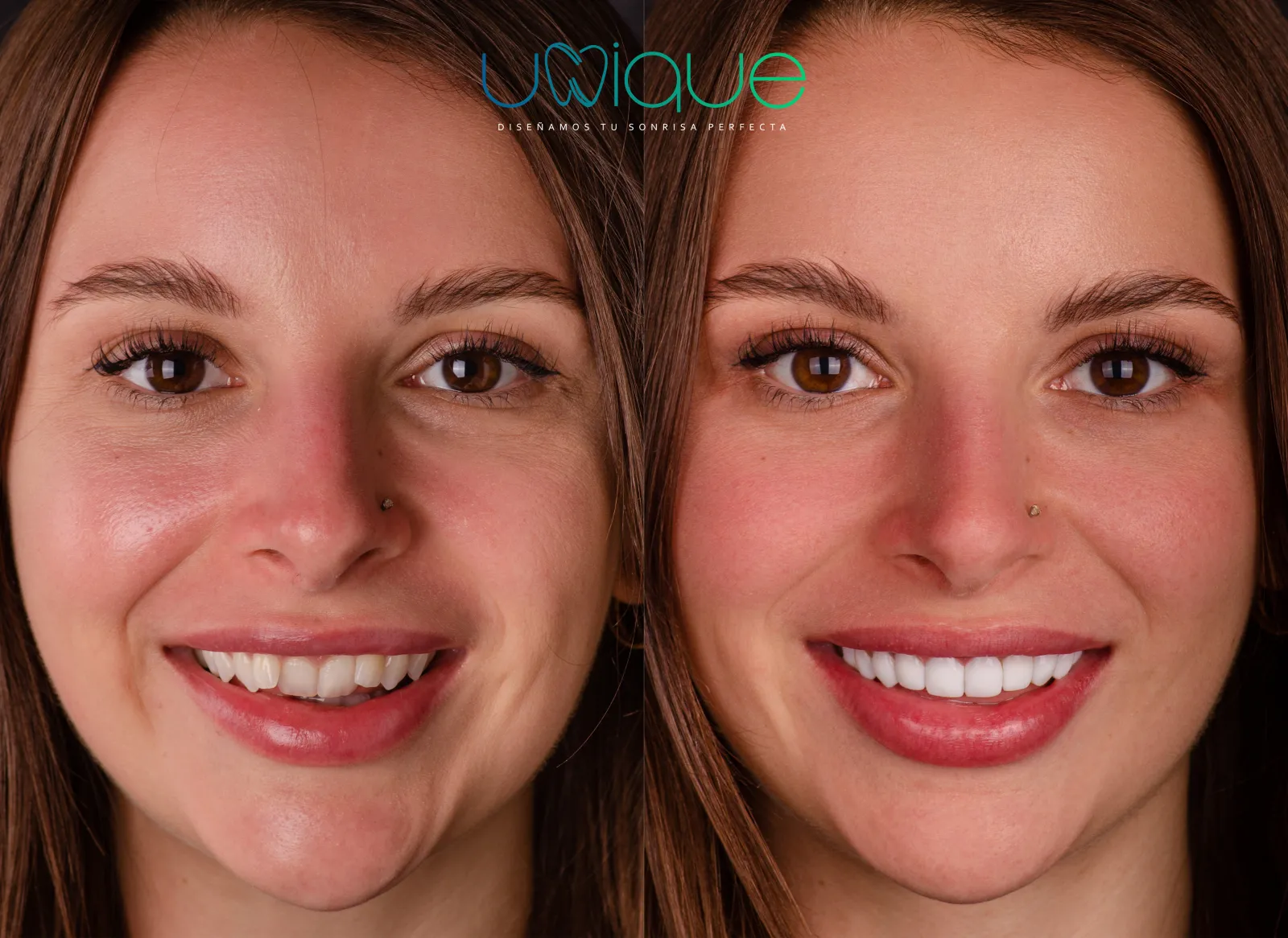 Resultado dental antes y después 6
